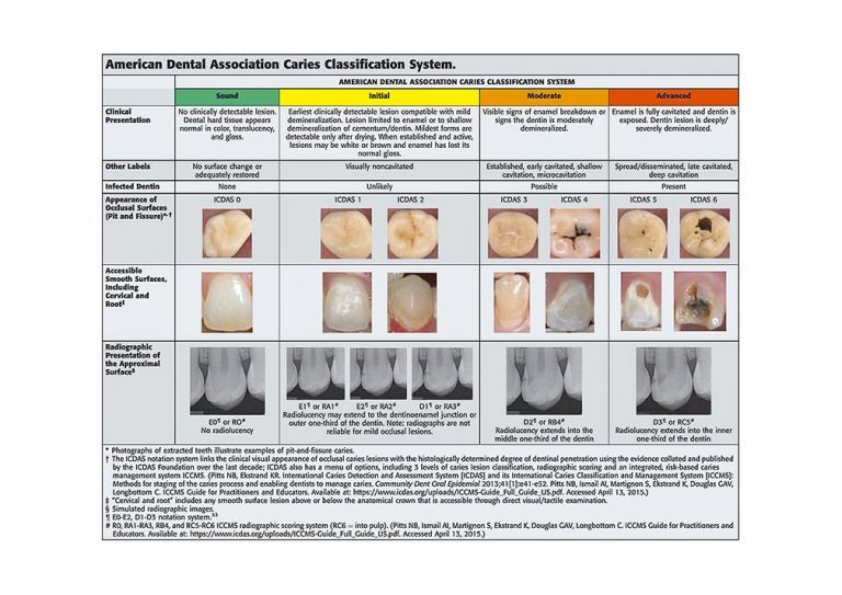 Dental Caries An Update on Dental Trends and Therapy University of
